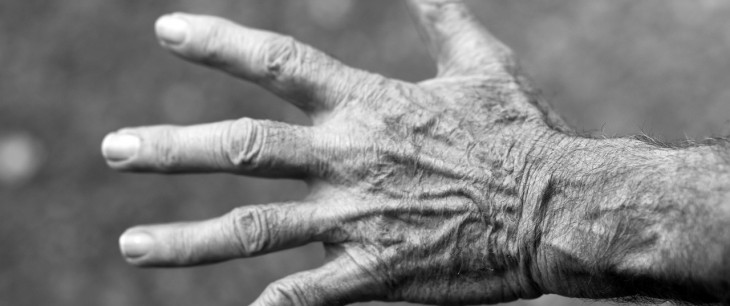Reuma: Príznaky, liečba a starostlivosť v každom veku