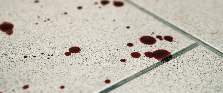 Krvácanie: Je hemorágia bežný jav alebo obava o život?