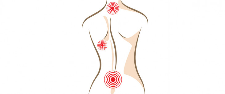 Artróza chrbtice: Vznik, príznaky, liečba a prevencia