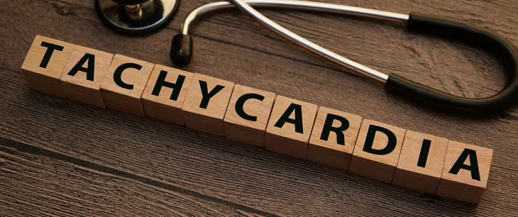 Tachykardia: Príčiny, príznaky, diagnostika a liečba