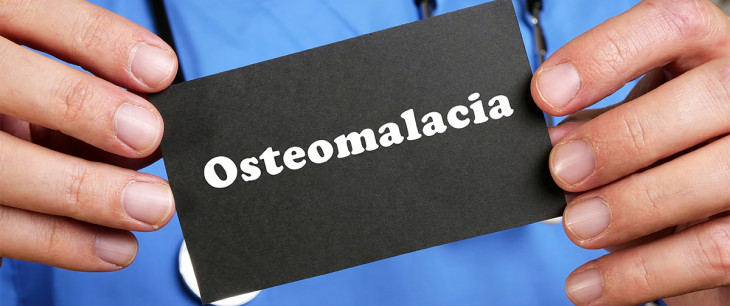 Osteomalácia: Mäknutie kostí a jeho liečba
